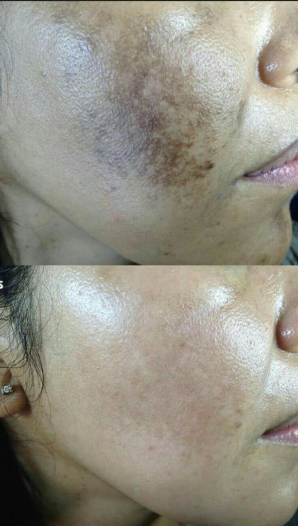 Bujari Elasticity Lotion